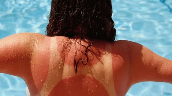 7 Things You Must Pack When Traveling to Costa Rica: photo 2